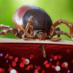 Tick-Paralysis