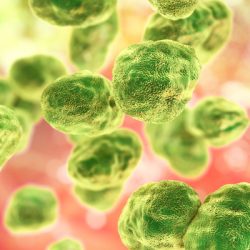 Tularemia